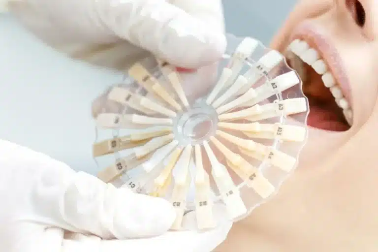 Veneers In Bangkok: Ablauf, Kosten Und Preisvergleich Mit Deutschland